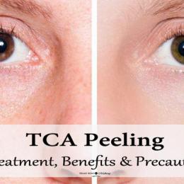 TCA Peeling: Treatment Details, Benefits, Precautions & Side Effects