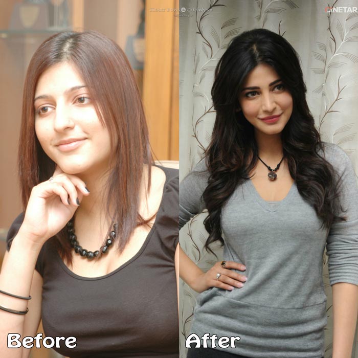 Top 10 Bollywood Plastic Surgeries Disasters: Before ...