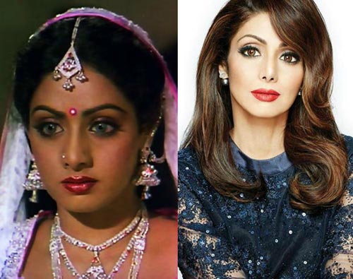 Top Bollywood Actress Skin Whitening Fairness Treatments Surgery