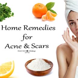 Effective Home Remedies For Acne & Scars