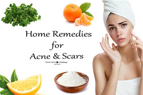 Effective Home Remedies For Acne & Scars