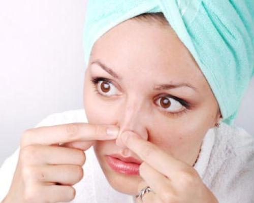How to Remove Blackheads on Nose & Face: Best Natural Remedies & Treatments
