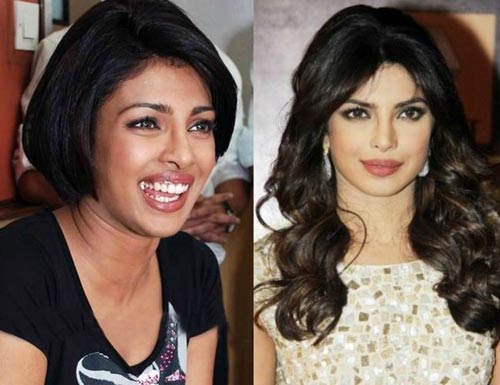 Bollywood Actresses That Got Skin Whitening Treatments 