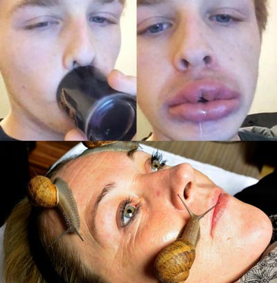 Crazy Beauty Trends 2016 Kylip Lip Challenge Snail Facial